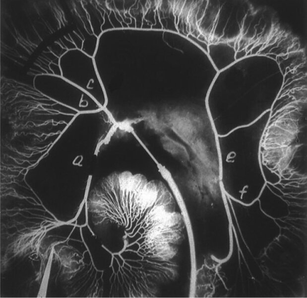 
 
 
 
 Rycina 4. Angiogram okrężnicy: (a) tętnica krętniczo-okrężnicza, (b) tętnica okrężnicza prawa, (c) tętnica okrężnicza środkowa, (e) tętnica okrężnicza lewa, (f) tętnica krezkowa dolna 