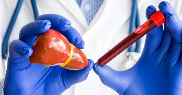 Coraz więcej osób ze stłuszczeniową chorobą wątroby. Konieczne zwiększenie diagnostyki?