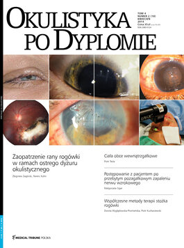 Okulistyka po Dyplomie (02/2014) 