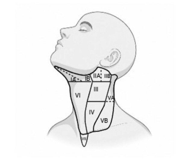 Rycina 2. Anatomiczny podział węzłów chłonnych szyi