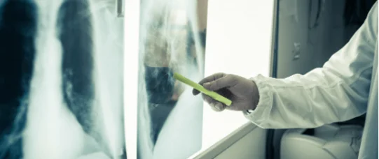 Potrzebna szybka ścieżka uznania COVID-19 za chorobę zawodową medyków