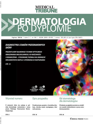 Dermatologia po Dyplomie 04/2016