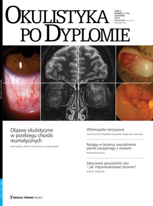 Okulistyka po Dyplomie 05/2013