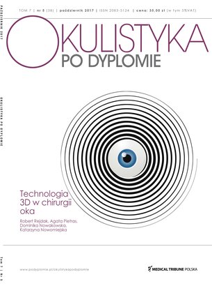 Okulistyka po Dyplomie 05/2017