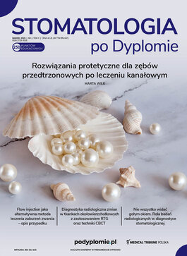 Stomatologia po Dyplomie (02/2025) 