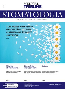 Stomatologia po Dyplomie (02/2020) 