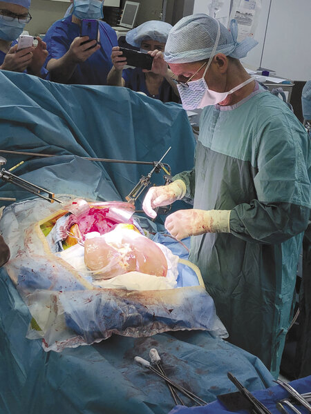Ryc. 1. Dr hab. med. Robert Król z przygotowaną do implantacji nową wątrobą, w tle z telefonem komórkowym Ewa Karmańska, perfuzjonistka.