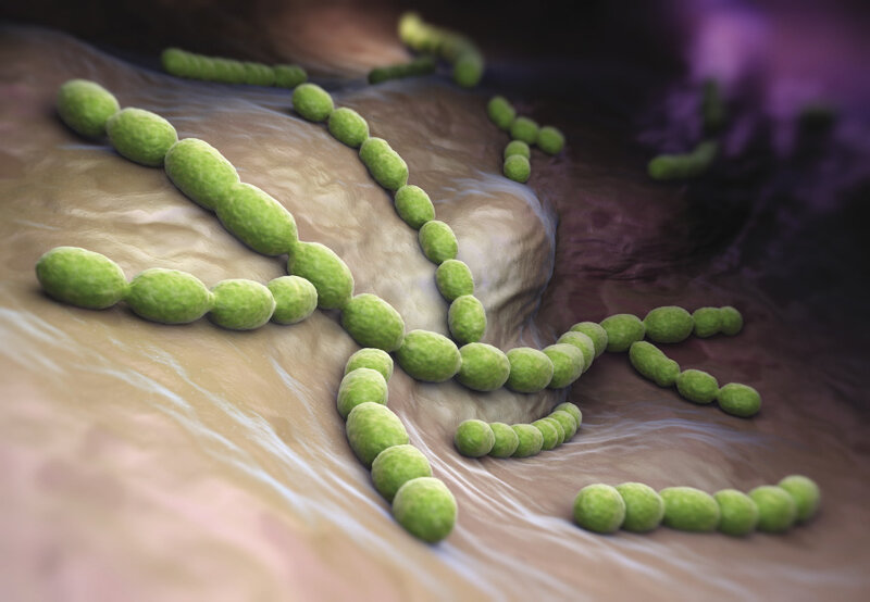 Dwoinka zapalenia płuc (Streptococcus pneumoniae)