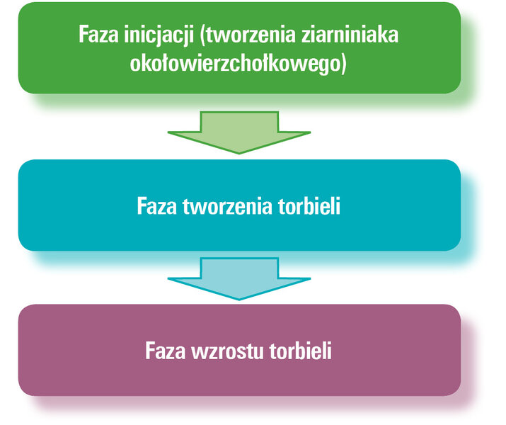 Ryc. 1. Proces powstawania torbieli.[4]