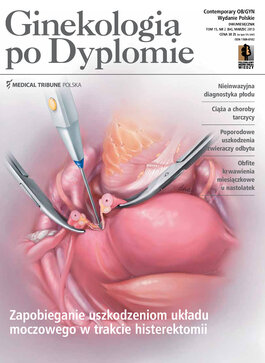 Ginekologia po Dyplomie (02/2013) 