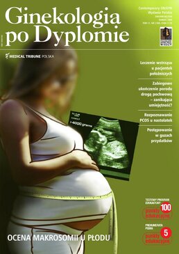 Ginekologia po Dyplomie (02/2009) 