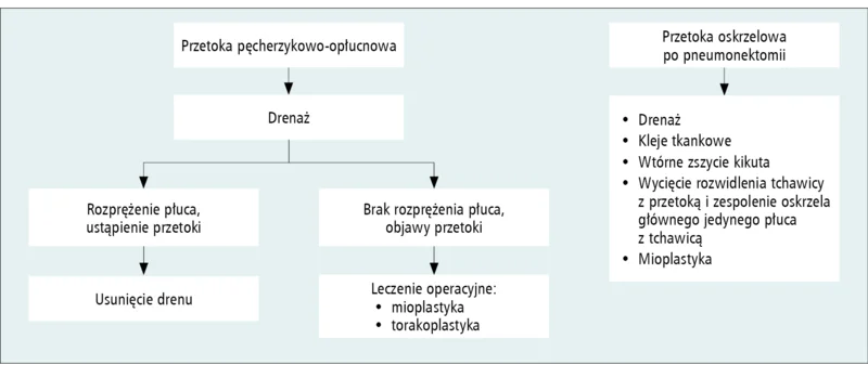 Rycina 2. Schemat postępowania u chorych z przetokami oskrzelowymi.