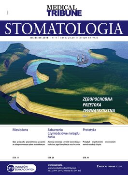 Stomatologia po Dyplomie (09/2018) 