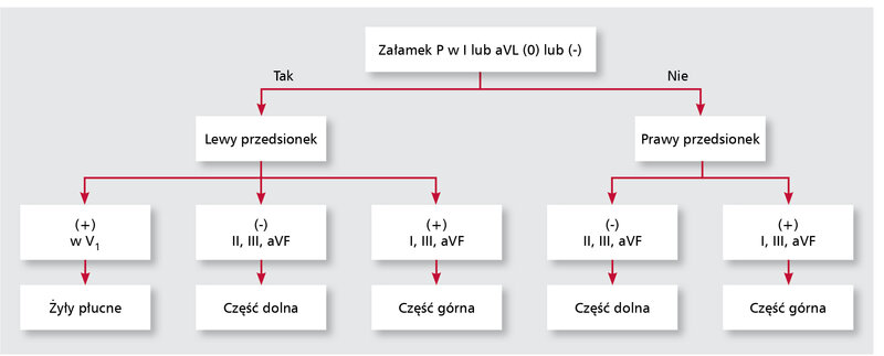 Rycina 1. Algorytm do określania lokalizacji punktu wyjścia ogniskowego częstoskurczu przedsionkowego na podstawie zapisu EKG.