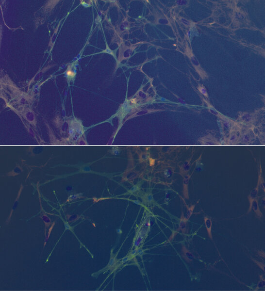 Ryc. 3-4. Glejowe komórki węchowe, fluorescencja zielona (p75NGFR); fibroblasty, fluorescencja czerwona (fibronektyna); jądra komórkowe, fluorescencja niebieska (Hoechst 33342).