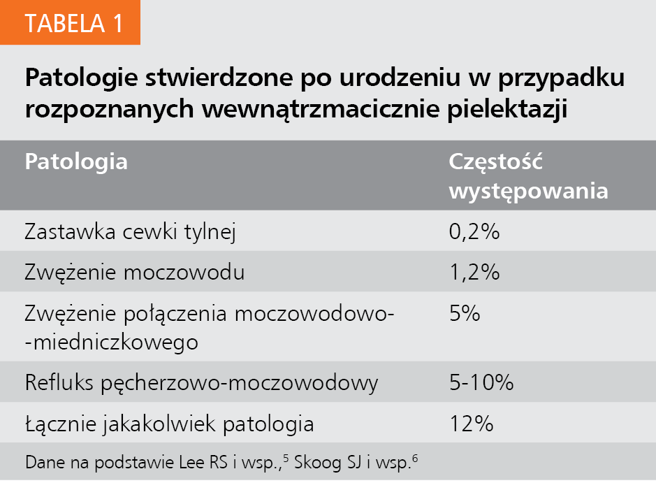 Tabela 1. Patologie stwierdzone po urodzeniu w przypadku rozpoznanych wewnątrzmacicznie pielektazji