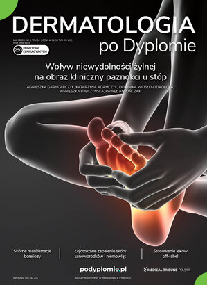 Dermatologia po Dyplomie 03/2023