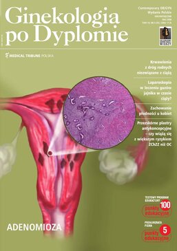 Ginekologia po Dyplomie (03/2008) 