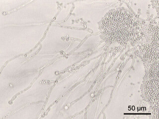 Candida albicans.