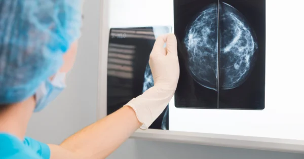 Klinika z Łodzi stosuje technikę usuwania guzów ukrywającą bliznę