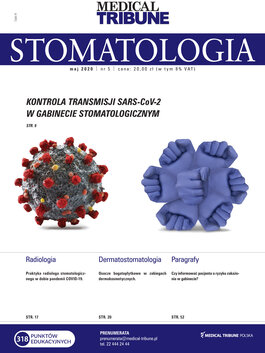 Medical Tribune Stomatologia (05/2020) 