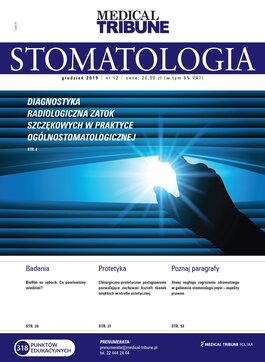 Medical Tribune - stomatologia (12/2019) 