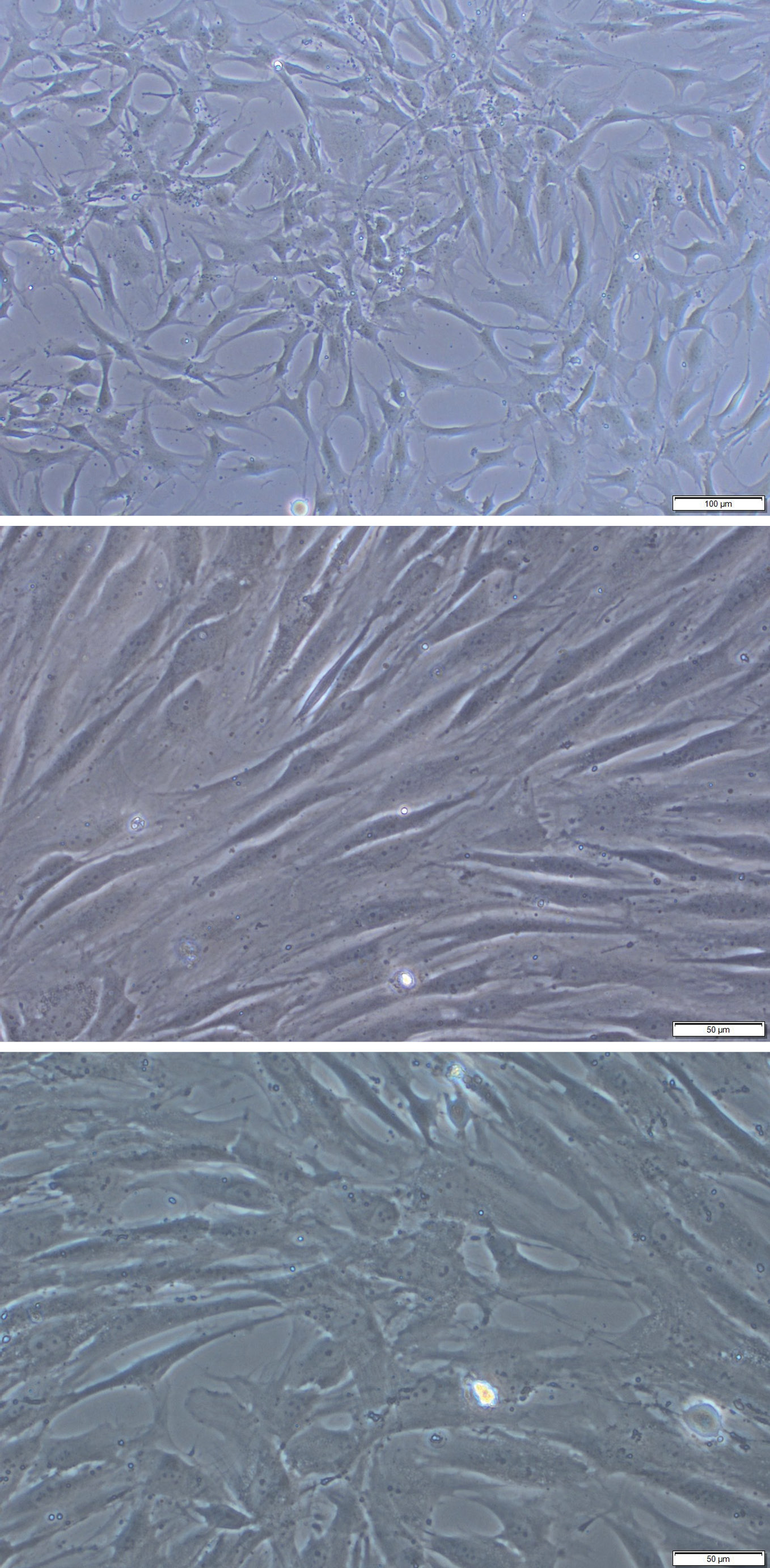 Ryc. 2. Chondrocyty izolowane z tkanki chrzęstnej w dwutygodniowej hodowli in vitro.