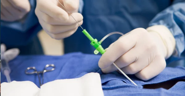 Pionierskie implantacje zastawki płucnej z wykorzystaniem Venus P-Valve