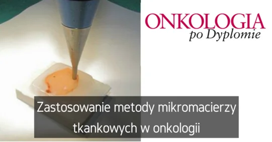 Zastosowanie metody mikromacierzy tkankowych w onkologii
