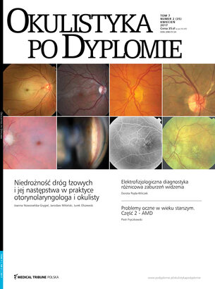 Okulistyka po Dyplomie 02/2017