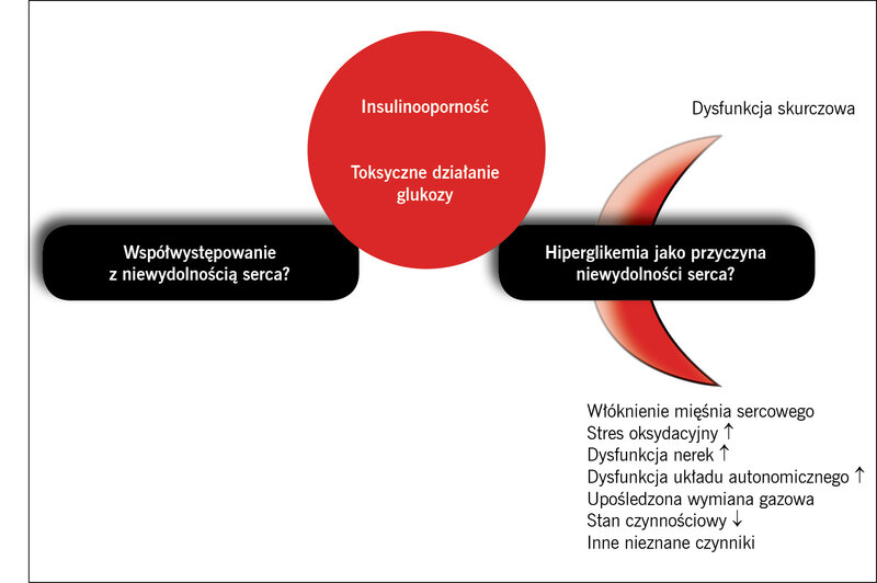 Rycina 1. Cukrzyca i niewydolność serca: złożone zależności patofizjologiczne.
