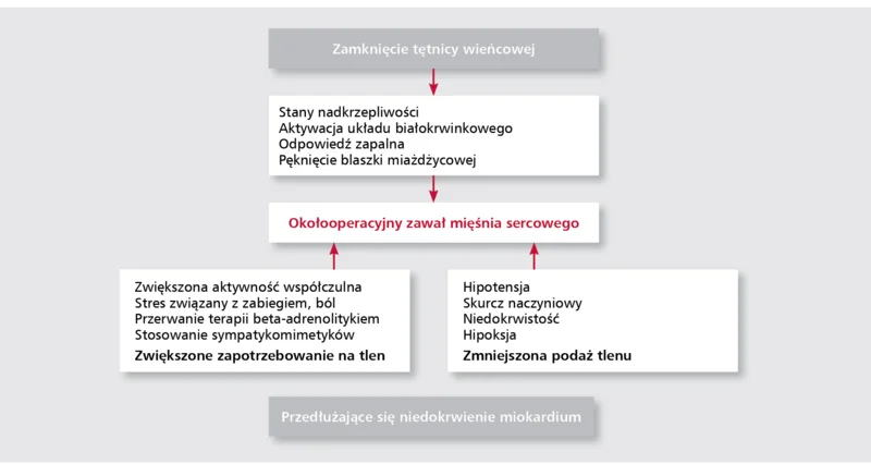 Rycina 1. Patomechanizm okołooperacyjnego zawału mięśnia sercowego.Na podstawie: Kertai i wsp. (2005).