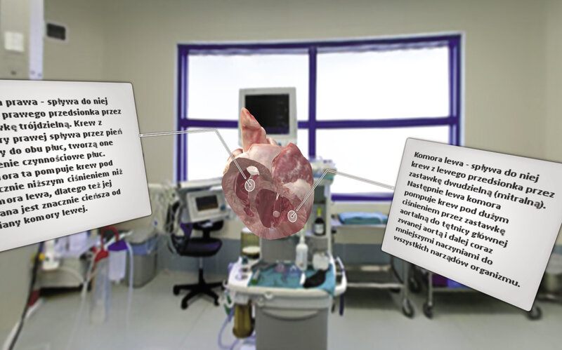 Ryc. 1. Techniki VR oraz AR pozwalają na obserwację anatomii serca w dowolnych przekrojach, co stwarza ogromne możliwości dydaktyczne lub związane z symulowaniem operacji.