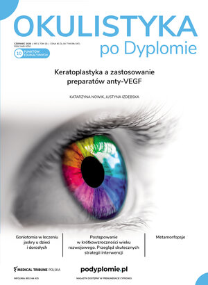 Okulistyka po Dyplomie 03/2026