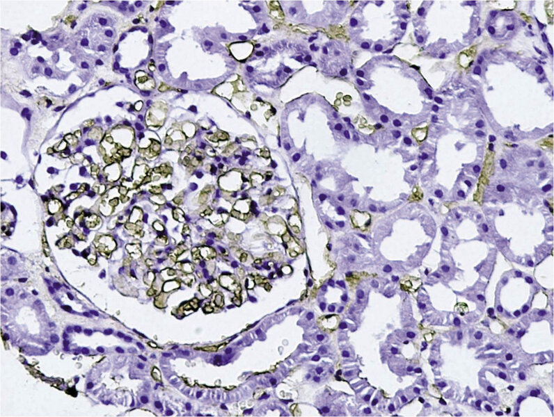 Rycina 2. Badanie immunohistochemiczne