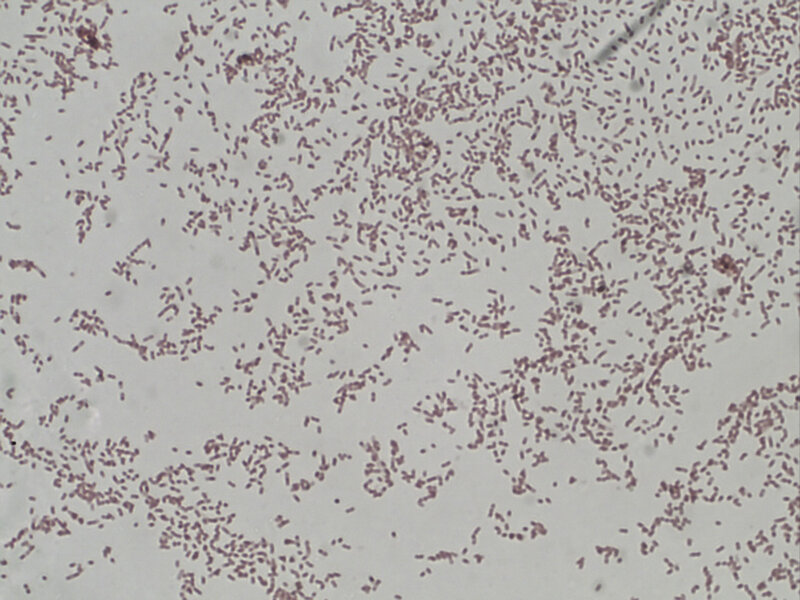 Rycina 1. Pseudomonas aeruginosa, preparat bezpośredni z hodowli barwiony metodą Grama