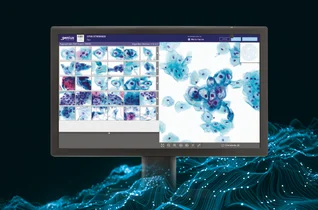 Nowoczesne rozwiązania w badaniach przesiewowych w kierunku raka szyjki macicy. Cytologia ThinPrep®, cyfrowa diagnostyka Genius™ i badanie Aptima® HPV mRNA