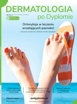 Dermatologia po Dyplomie (04/2022) 