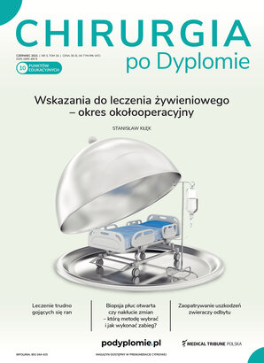 Chirurgia po Dyplomie 03/2021