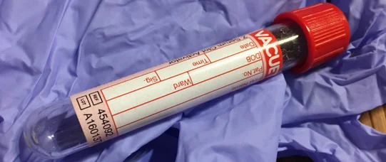 „Nie” dla autoryzacji badań na odległość  