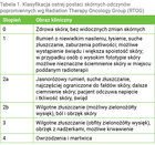 w popromiennych wg Radiation Therapy Oncology