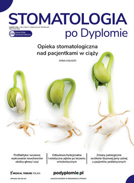 Stomatologia po Dyplomie (02/2023) 