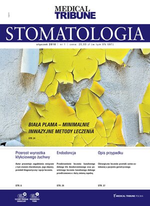 Stomatologia po Dyplomie 01/2018