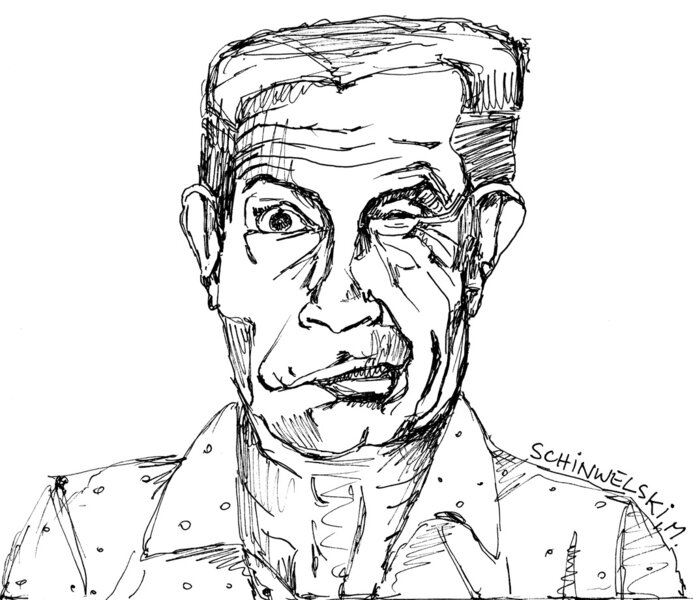 Rycina 3. Połowiczy kurcz twarzy (hemifacial spasm).