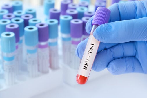 NFZ ogłosił koniec tradycyjnej cytologii