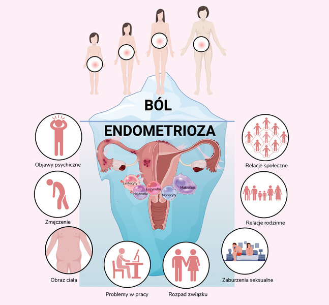 Rycina 1. Endometrioza i zaburzenia z nią związane