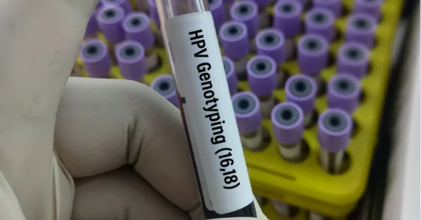 Klasyczna cytologia idzie do lamusa. MZ wprowadza refundację testów genetycznych
