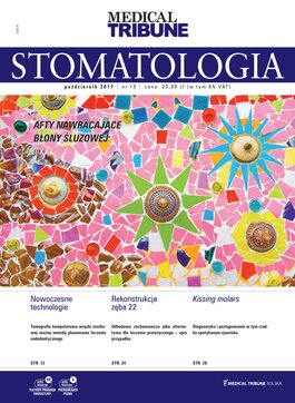 Stomatologia po Dyplomie (10/2017) 