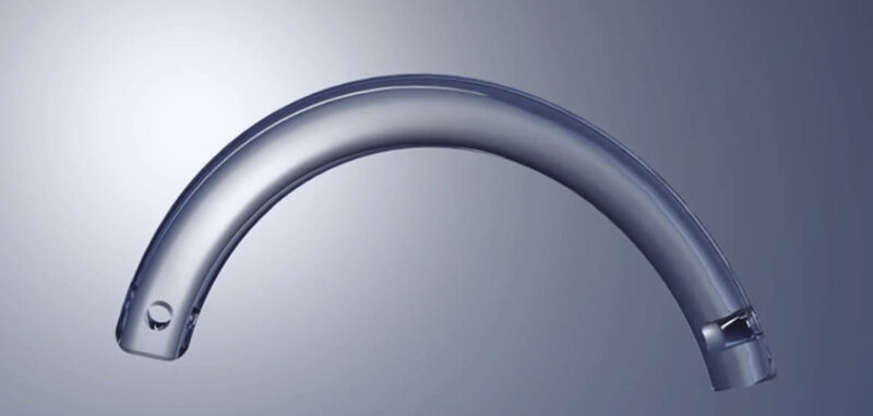 Rycina 3. Implant śródrogówkowy Ferrara ring. Dzięki uprzejmości AJL Ophthalmic