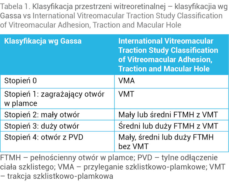Tabela 1. Klasyfikacja przestrzeni witreoretinalnej – klasyfikacjia wg Gassa vs International Vitreomacular Traction Study Classification of Vitreomacular Adhesion, Traction and Macular Hole